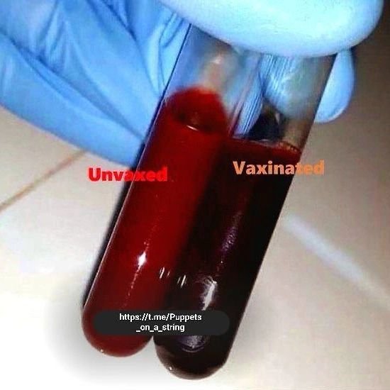 non-vaccines-versus-vaccines.jpg