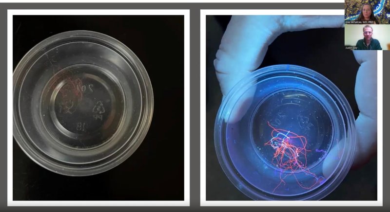 filaments-bioluminescents-sous-la-lumiere-uv-apres-une-douche-chaude.jpg