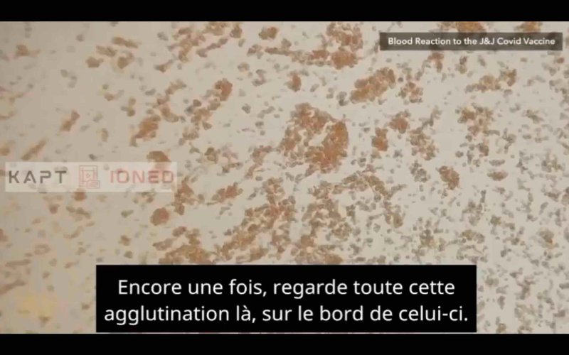 l-agglutination-des-cellules.jpg