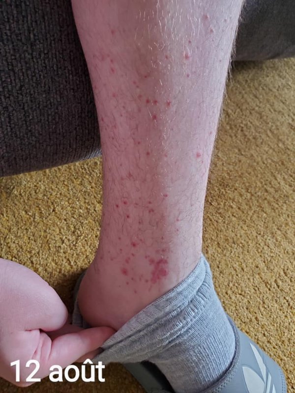 fils-apres-la-vaccination-1.jpg