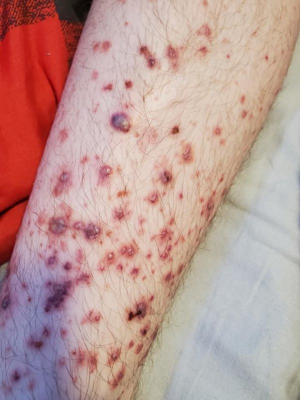 fils-apres-la-vaccination-2.jpg