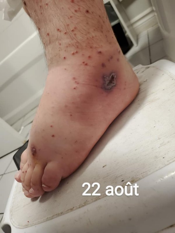 fils-apres-la-vaccination-4.jpg