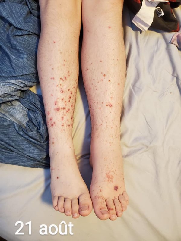 fils-apres-la-vaccination-5.jpg