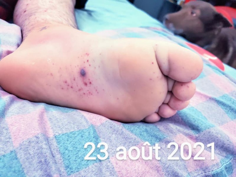 fils-apres-la-vaccination-6.jpg