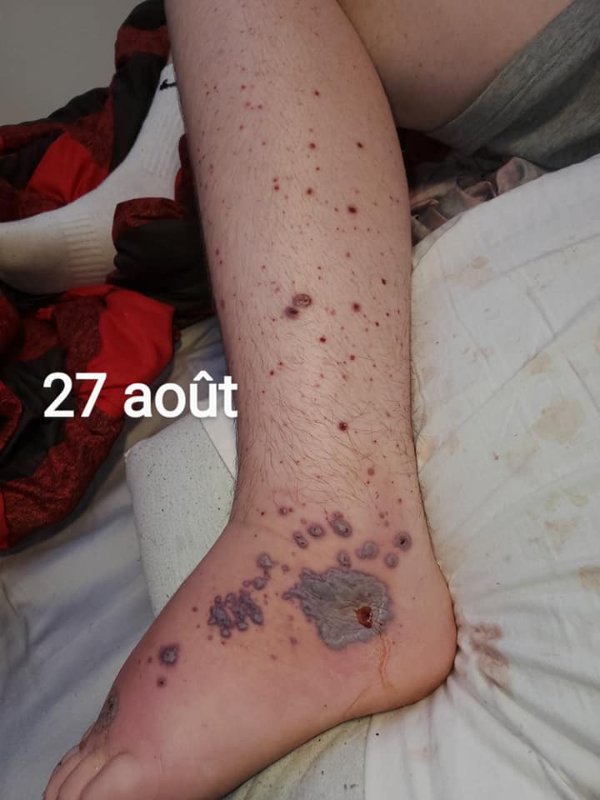 fils-apres-la-vaccination-7.jpg
