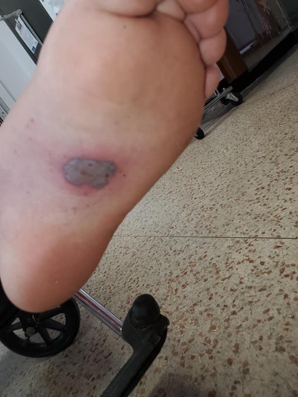 fils-apres-la-vaccination-12.jpg