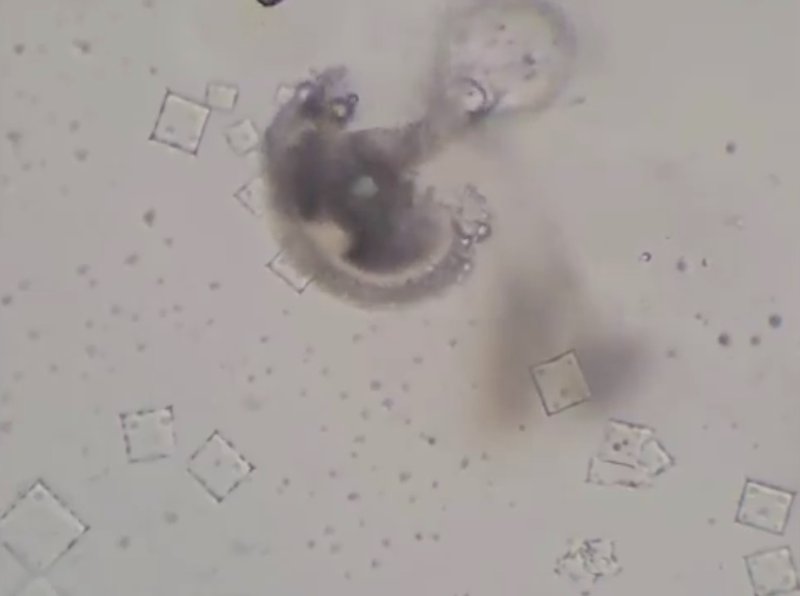 la-nicotine-detruit-les-nanobots-dans-l-anesthesian-dentaire.jpg