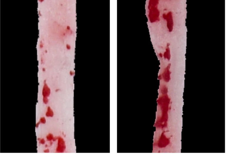 Les souris nourries à l’aspartame (à droite) ont développé des plaques plus grandes et plus nombreuses (rouges) dans leurs artères (roses) par rapport aux souris qui n’ont jamais consommé d’édulcorant. Crédit : Wu et al., Cell Metabolism