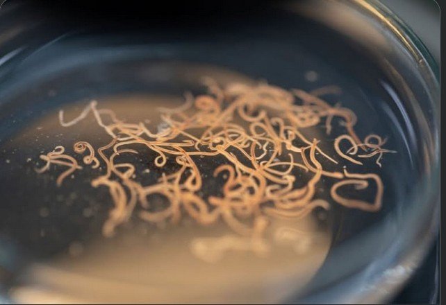 parasites-et-vers-intestinaux-dans-les-humains.jpg