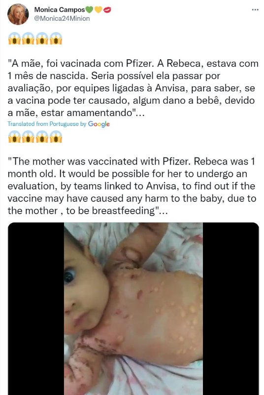 le-bebe-affecte--suite-a-la-vaccination-pfizer-de-sa-mere.JPG