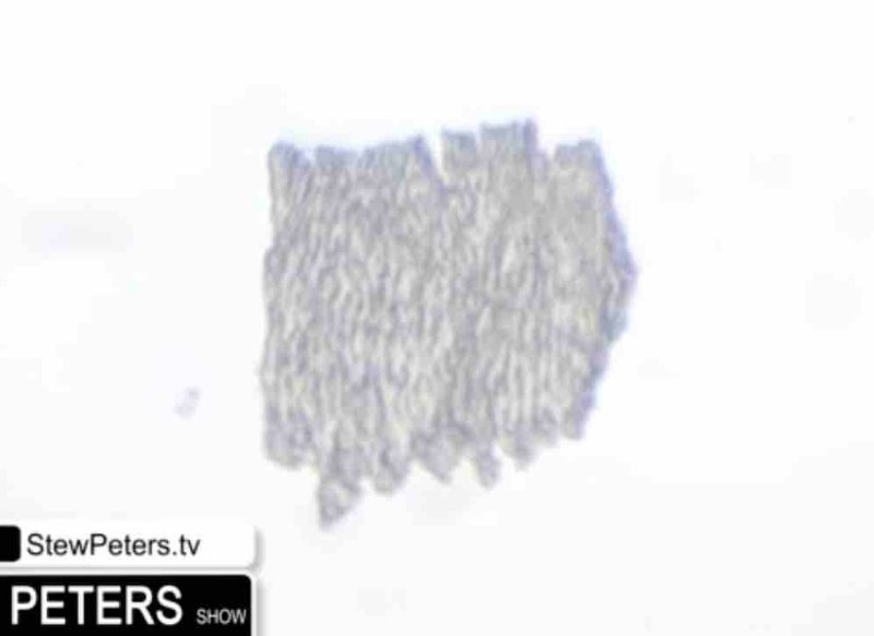 ce-qui-ressemble-a-du-graphene-dans-levaccin-jnj.jpg