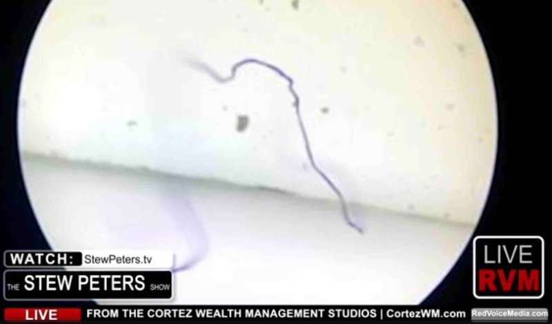 fibres-dans-le-vaccin-moderna.jpg