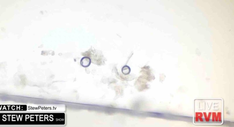 les-particules-qui-se-rendaient-aux-extremitees-de-la-plaquette-sous-le-microscope.jpg