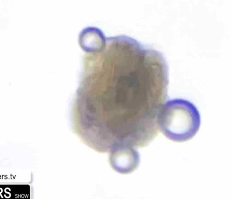 structure-coloree-inconnue-dans-le-vaccin-jnj.jpg