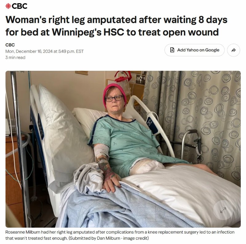 Source: https://ca.news.yahoo.com/womans-leg-amputated-waiting-8-224928983.html