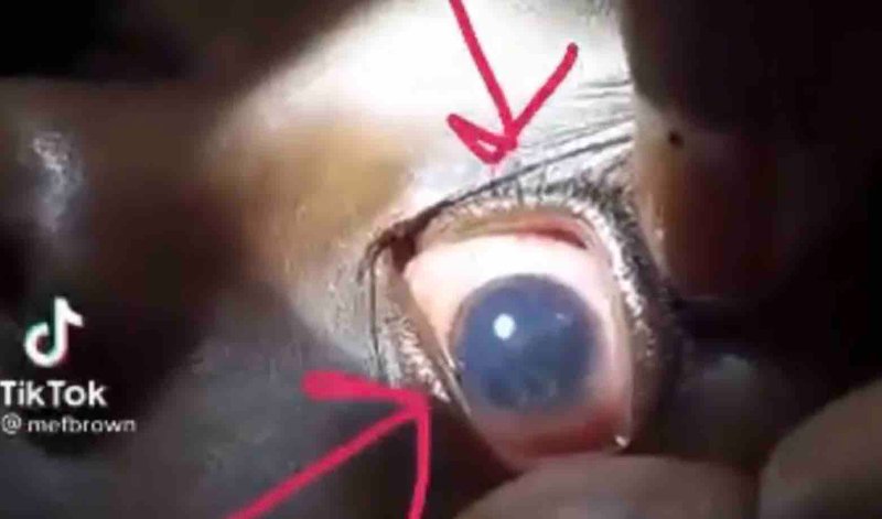 regardez-l-organisme-dans-son-oeil-1.jpg