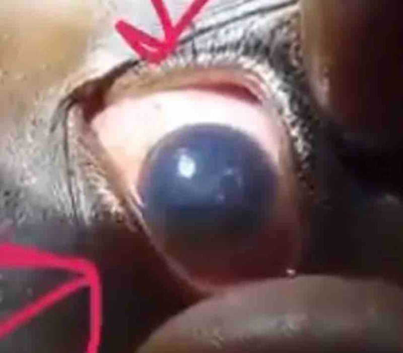 regardez-l-organisme-dans-son-oeil-3.jpg