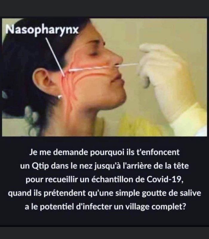les-ecouvillons-servent-a-vous-blesser.jpg