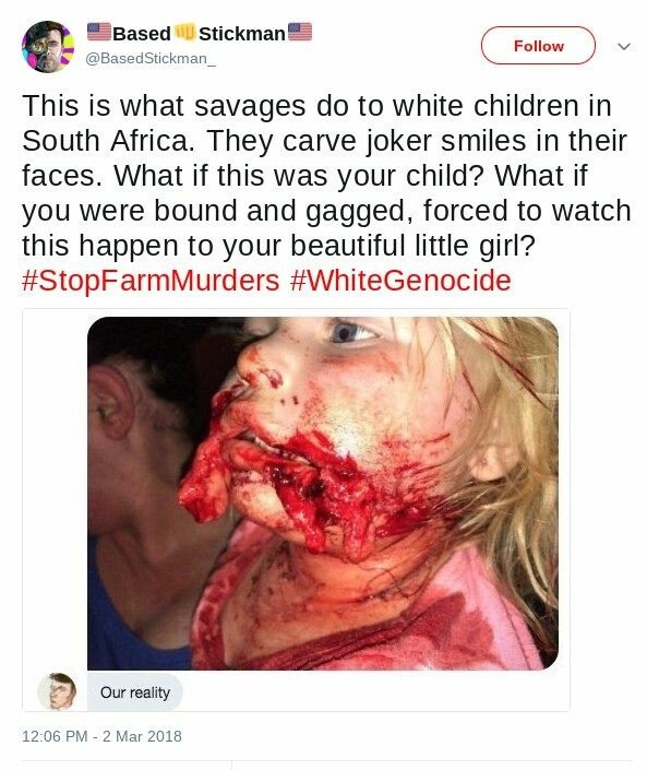 enfant-sauvagement-attaquee.jpg