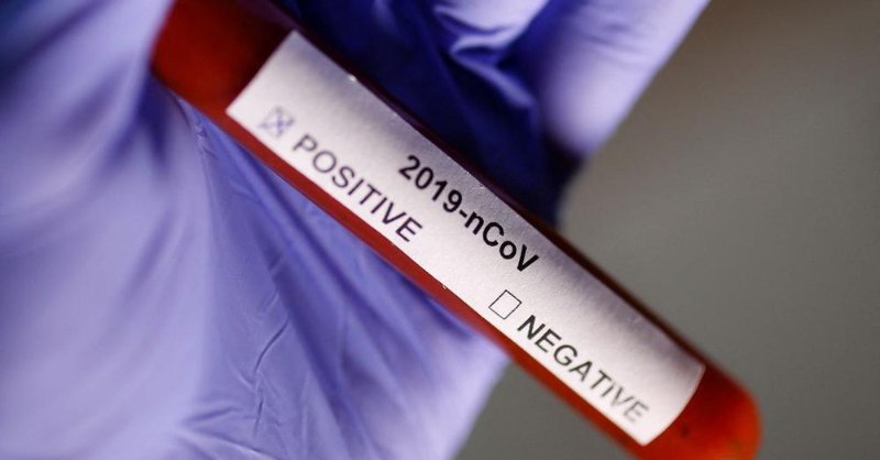 positif-ou-non-a-la-covid.jpg