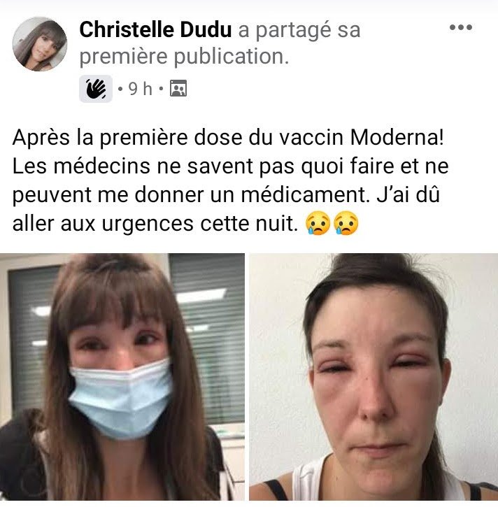 apres-la-1ere-dose-de-vaccin-moderna.jpg