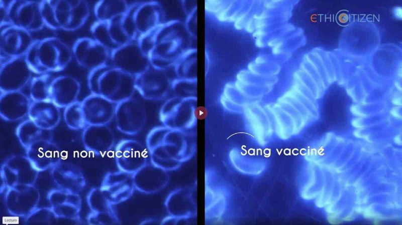 sang-vaccine-verssus-non-vaccine.jpg
