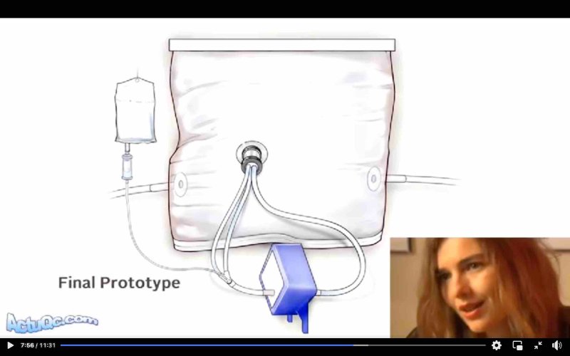 prototype-final-d-uterus-artificiel.jpg