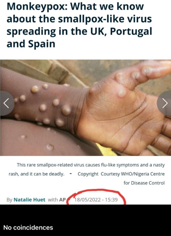monkeypox-in-europe-18th-of-may-2022.jpg
