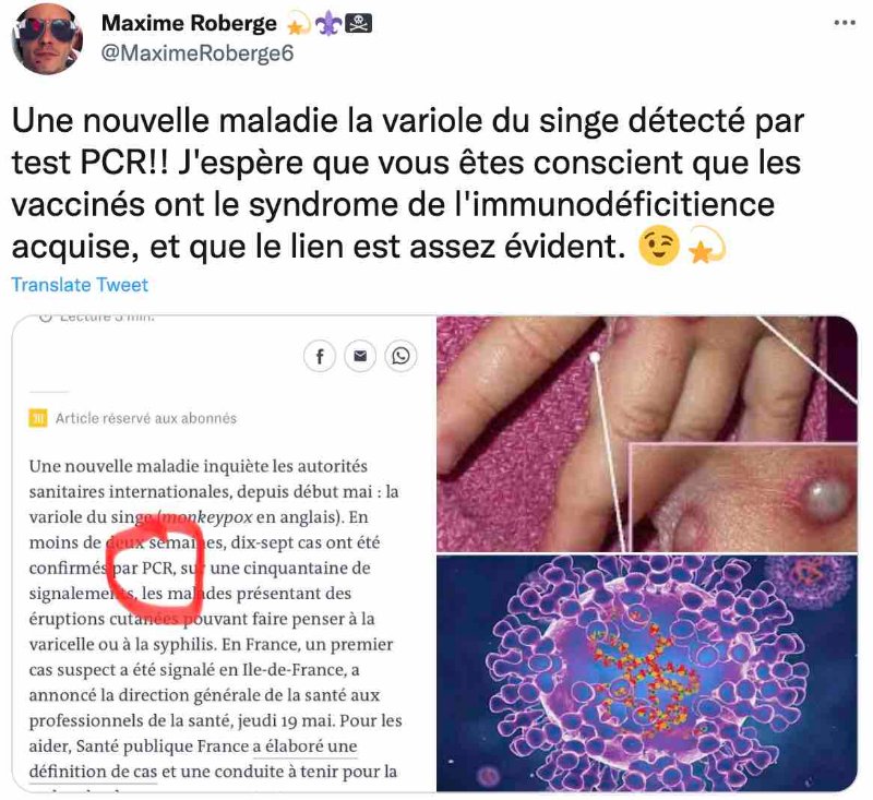 test-pcr-et-variole-du-singe.jpg