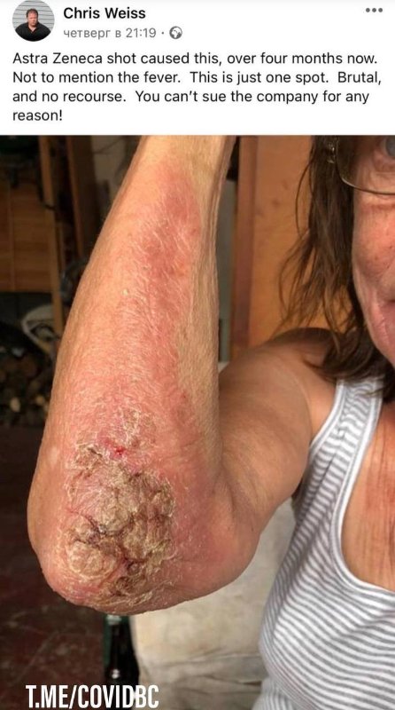 qu-est-ce-qu-ils-ont-mis-dans-les-vaccins-covid-19-d-az.jpeg