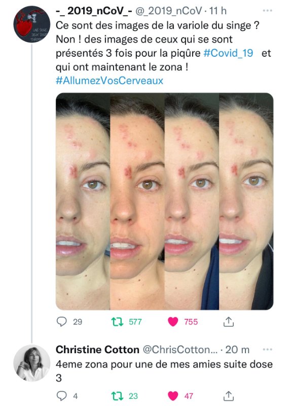 zona-post-vaccinal-covid.jpg
