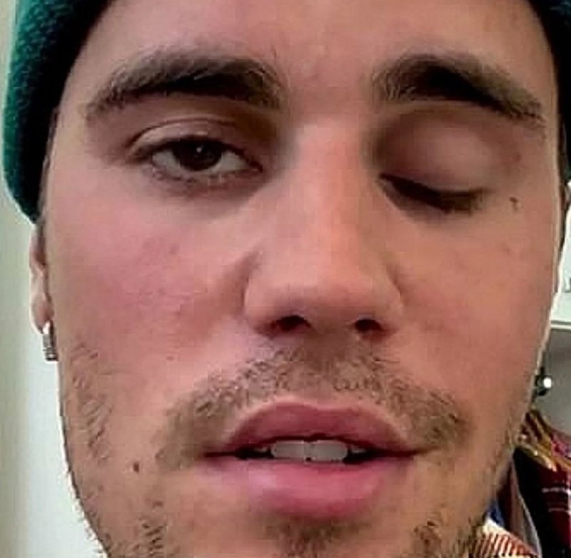 justin-bieber-vaccine.jpeg