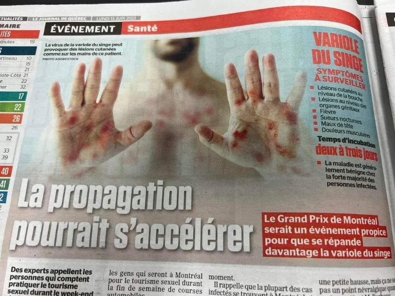 publicite-pour-la-propagation-de-la-variole-du-singe.jpg