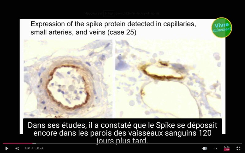 le-dr-burkart-qui-parle-des-proteines-spike-120-jours-plus-tard-dans-les-vaisseaux-sanguins.jpg
