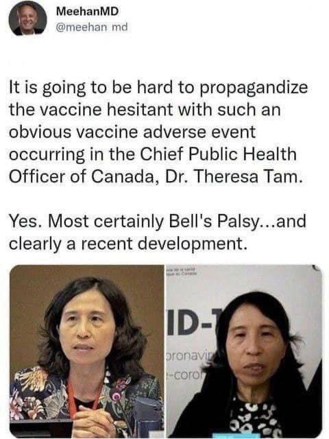 theressa-tam-cache-mal-sa-paralysie-de-bell.jpg