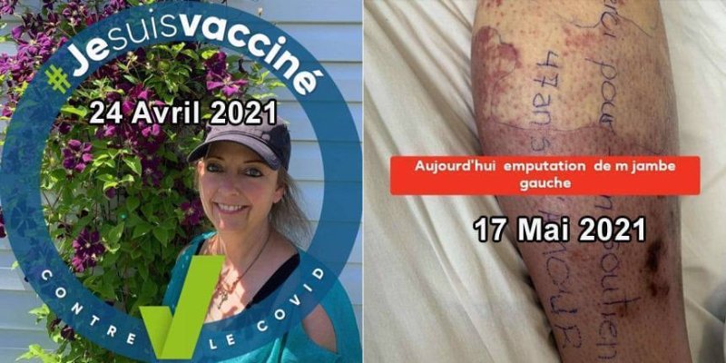 les-vrais-effets-de-la-vaccination-covid.jpg