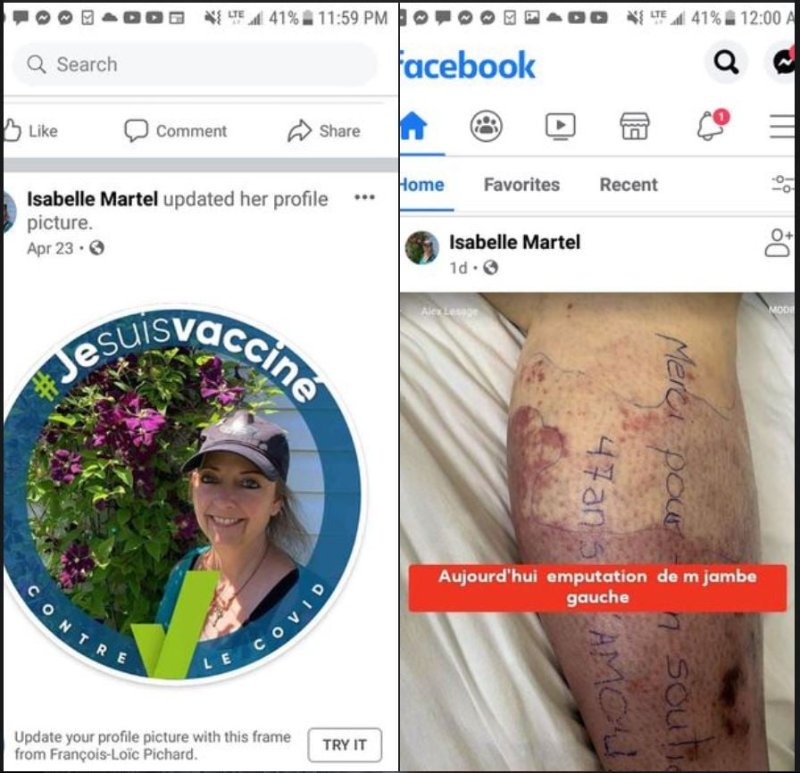 isabelle-martel-et-la-suite-de-son-vaccin.jpg