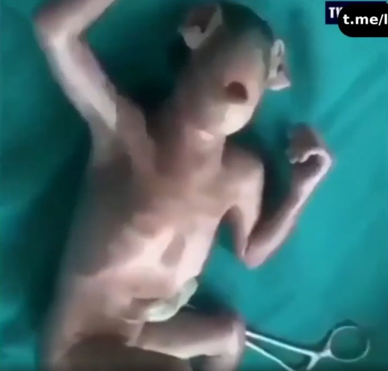 chimere-montree-a-la-naissance.jpg