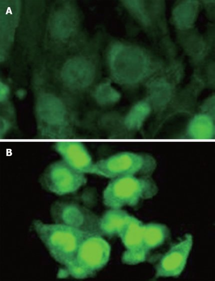 Activation de la β-caténine dans les cellules épithéliales du côlon par la Chitinase 3-like-1 purifiée (CHI3L1). Les cellules cancéreuses du côlon humain SW480 ont été cultivées sans (A) ou avec la protéine CHI3L1 humaine purifiée (50 ng / mL) pendant 24 h (B), et les cellules ont été colorées avec un anticorps monoclonal anti-caténine anti-humain β de souris suivi d'une coloration IgG anti-souris anti-souris. Chi3L1 purifié stimule de manière significative la translocation nucléique de la β-caténine dans les cellules SW480. Grossissement d'origine, objectif 40 ×.