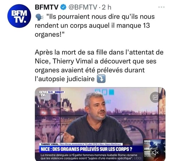 organes-preleves-lors-de-l-autopsie-judiciaire.jpeg