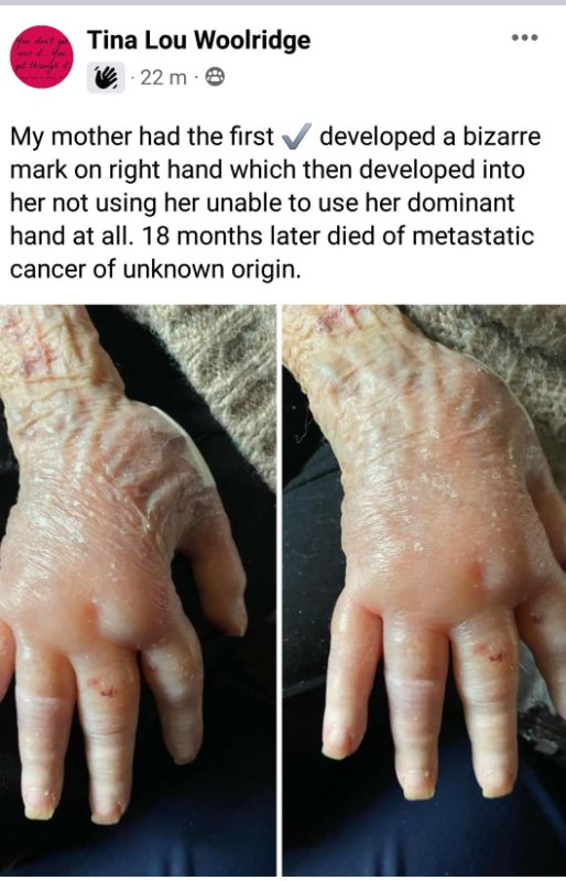 cancer-metastatique-d-origine-inconnue.jpg