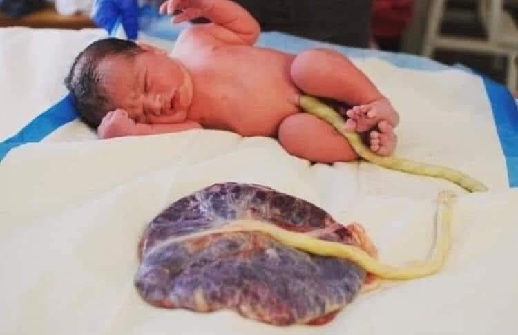 bebe-naissant-et-son-placenta.jpg