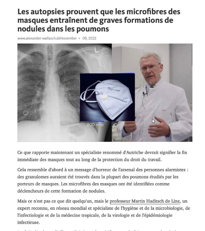 nodules-aux-poumons-suite-au-port-du-masque.jpeg