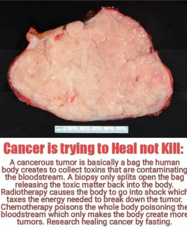 le-cancer-tente-de-guerir-et-non-de-tuer.jpg