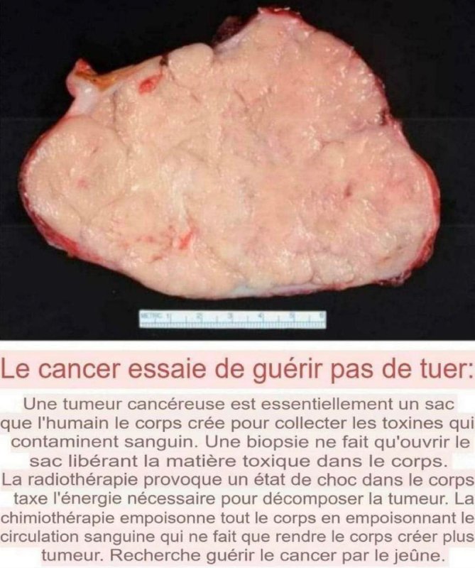le-cancer-essaie-de-guerir.jpg