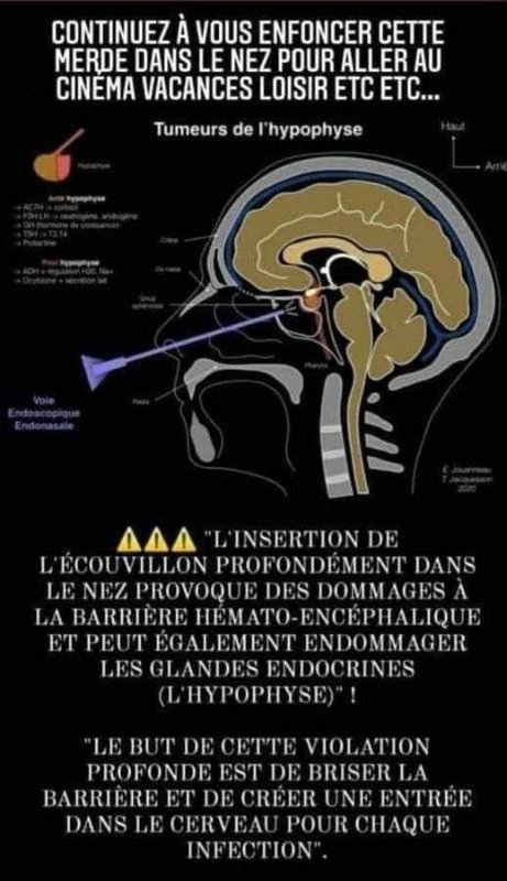 le-risque-reel-de-l-ecouvillon-nasal.jpeg