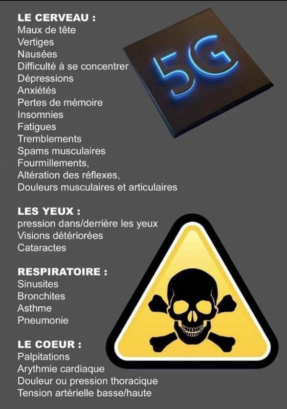 effets-de-la-5g.jpg