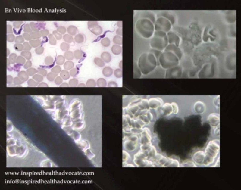 analyse-de-sang-vivant-avec-les-globules-rouges-en-rouleaux.jpg